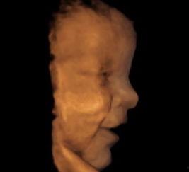 腹中子,揭秘生命起源的神秘力量